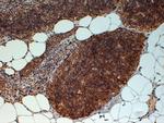 FOXN1 Antibody in Immunohistochemistry (Paraffin) (IHC (P))