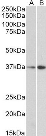 MRG15 Antibody in Western Blot (WB)