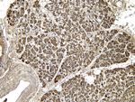 EPS8 Antibody in Immunohistochemistry (Paraffin) (IHC (P))