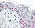 PTBP1 Antibody in Immunohistochemistry (Paraffin) (IHC (P))