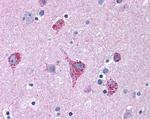 MUNC18 Antibody in Immunohistochemistry (Paraffin) (IHC (P))