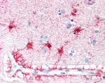 VPS45 Antibody in Immunohistochemistry (Paraffin) (IHC (P))