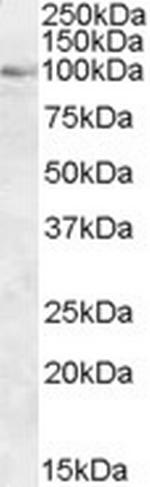 OSBP Antibody in Western Blot (WB)