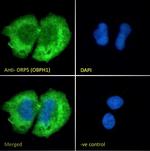 ORP5 Antibody in Immunocytochemistry (ICC/IF)