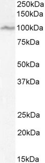 ORP5 Antibody in Western Blot (WB)