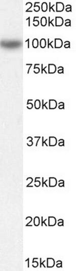 ORP5 Antibody in Western Blot (WB)