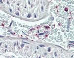 Pleckstrin Antibody in Immunohistochemistry (Paraffin) (IHC (P))