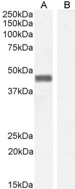 Pleckstrin Antibody in Western Blot (WB)