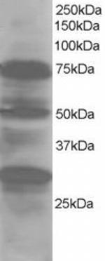 LMO7 Antibody in Western Blot (WB)