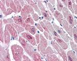 PAR6 Antibody in Immunohistochemistry (Paraffin) (IHC (P))