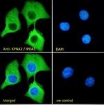 KPNA2 Antibody in Immunocytochemistry (ICC/IF)