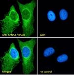 KPNA2 Antibody in Immunocytochemistry (ICC/IF)