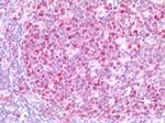 KPNA2 Antibody in Immunohistochemistry (Paraffin) (IHC (P))