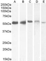 KPNA2 Antibody in Western Blot (WB)