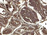 KPNA3 Antibody in Immunohistochemistry (Paraffin) (IHC (P))