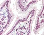 KPNA4 Antibody in Immunohistochemistry (Paraffin) (IHC (P))