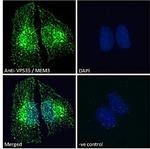 VPS35 Antibody in Immunocytochemistry (ICC/IF)