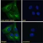 VPS35 Antibody in Immunocytochemistry (ICC/IF)