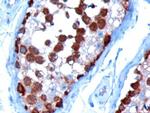 TCP1 Antibody in Immunohistochemistry (Paraffin) (IHC (P))