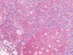 TCP1 Antibody in Immunohistochemistry (Paraffin) (IHC (P))