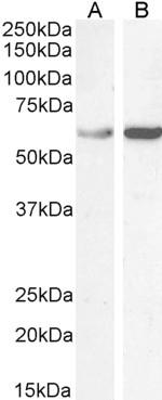 TCP1 Antibody in Western Blot (WB)