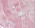 SIRT4 Antibody in Immunohistochemistry (Paraffin) (IHC (P))