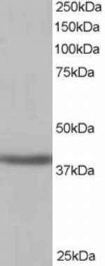 SIRT4 Antibody in Western Blot (WB)