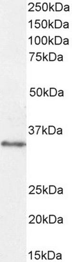 VDAC2 Antibody in Western Blot (WB)