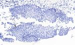 PAX3 Antibody in Immunohistochemistry (Paraffin) (IHC (P))