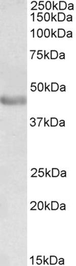 PAX3 Antibody in Western Blot (WB)