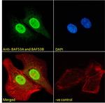 BAF53A/BAF53B Antibody in Immunocytochemistry (ICC/IF)