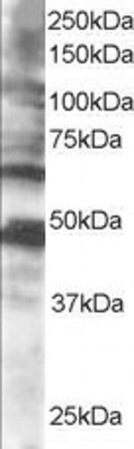 CPEB1 Antibody in Western Blot (WB)