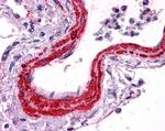 Alpha-Smooth Muscle Actin Antibody in Immunohistochemistry (Paraffin) (IHC (P))