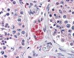 PPAR delta Antibody in Immunohistochemistry (Paraffin) (IHC (P))