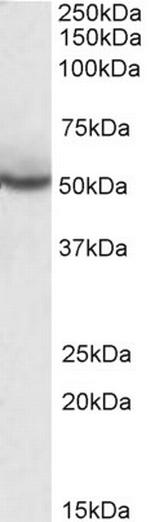 PPAR delta Antibody in Western Blot (WB)