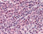 LXR beta Antibody in Immunohistochemistry (Paraffin) (IHC (P))