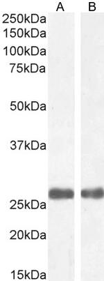 MBL2 Antibody in Western Blot (WB)