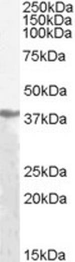 Alcohol dehydrogenase Pan Antibody in Western Blot (WB)