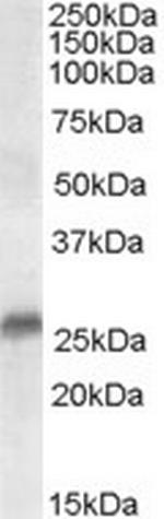 SRD5A2 Antibody in Western Blot (WB)