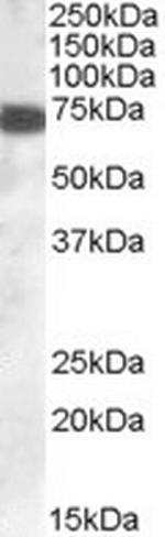 ZDHHC13 Antibody in Western Blot (WB)