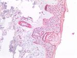 NPM1 Antibody in Immunohistochemistry (Paraffin) (IHC (P))