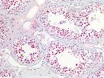 NPM1 Antibody in Immunohistochemistry (Paraffin) (IHC (P))