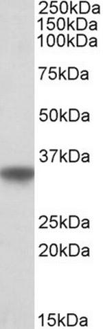 APOE Antibody in Western Blot (WB)