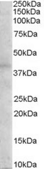 MC3R Antibody in Western Blot (WB)