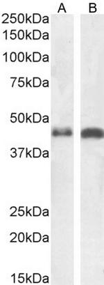 beta-Arrestin 2 Antibody in Western Blot (WB)