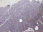 CCKBR Antibody in Immunohistochemistry (Paraffin) (IHC (P))