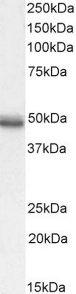 CCKBR Antibody in Western Blot (WB)