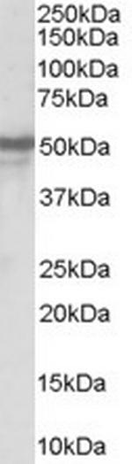 NPY5R Antibody in Western Blot (WB)