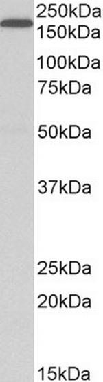 LRP5 Antibody in Western Blot (WB)