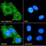 Arginase 1 Antibody in Immunocytochemistry (ICC/IF)